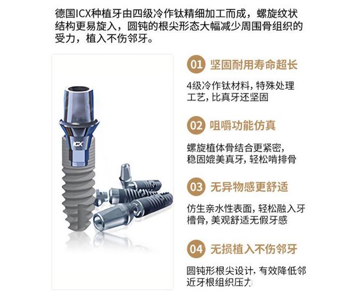 德國icx種植牙優(yōu)勢介紹