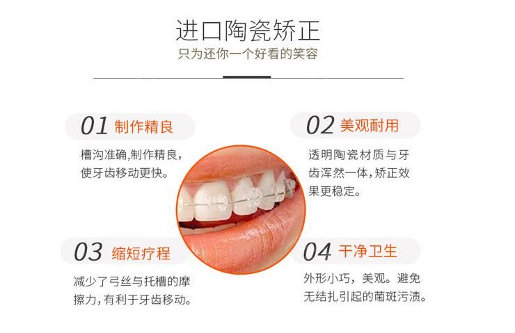 進(jìn)口陶瓷矯正優(yōu)勢介紹
