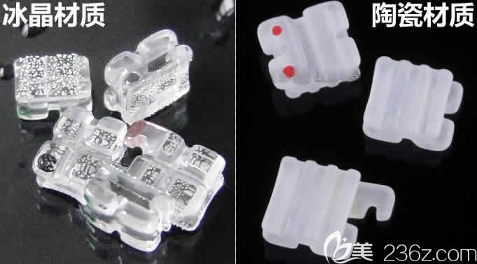 冰晶托槽和陶瓷托槽矯正材質(zhì)對比圖