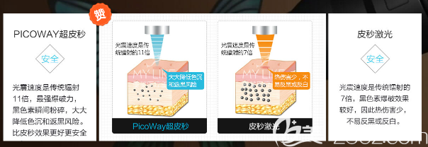 深圳美萊超皮秒激光祛斑原理 深圳美萊超皮秒激光祛斑原理