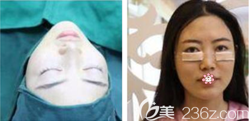 劉德東醫(yī)生給我手術(shù)的當(dāng)天