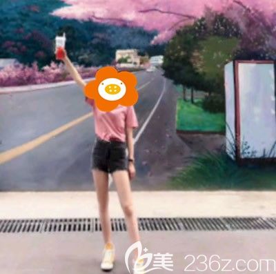 到泉州做大腿吸脂滿三個(gè)月，今天來聊聊我的心路歷程