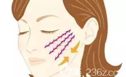 微創(chuàng)手術(shù)除皺