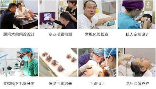 濟南名韓植發(fā)手術流程 濟南名韓植發(fā)手術流程