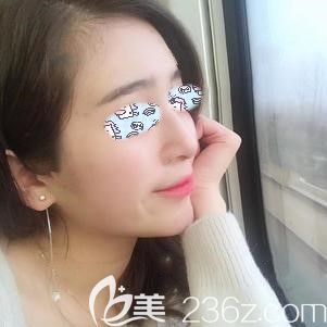 做艷冠硅膠假體15天后用手托腮沒問題 做艷冠硅膠假體15天后用手托腮沒問題