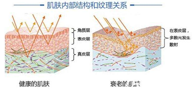 健康肌膚與衰老肌膚對(duì)比圖 健康肌膚與衰老肌膚對(duì)比圖