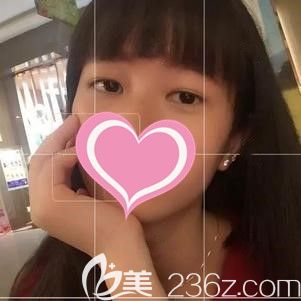 這是老司機(jī)在手術(shù)前的眼睛 這是老司機(jī)在手術(shù)前的眼睛