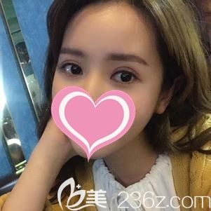 李院長(zhǎng)做小眼綜合術(shù)后25天疤痕逐漸淡化 李院長(zhǎng)做小眼綜合術(shù)后25天疤痕逐漸淡化