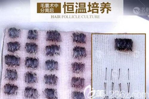 毛囊提取后要進行分離培育