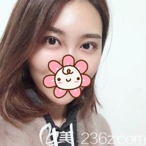 拆線第三天眼睛恢復(fù)情況