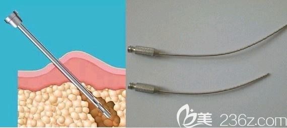 維納斯吸脂的兩根軟針管