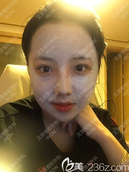 艾恩整形術(shù)后第11天