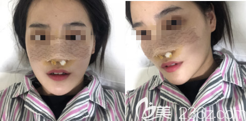 想起之前被大家<span style=