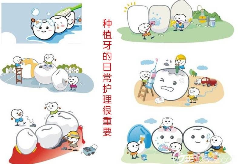 種植牙術(shù)后護(hù)理