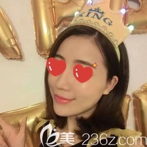 楊醫(yī)生做脂肪填充面部術(shù)后30天腫脹消失 楊醫(yī)生做脂肪填充面部術(shù)后30天腫脹消失