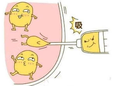 大腿吸脂術(shù)后暴飲暴食體重還是會(huì)反彈但只是脂肪細(xì)胞體積增大了