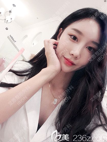 自從在韓國艾恩做完手術(shù)后我的臉上寫滿了自信和幸福