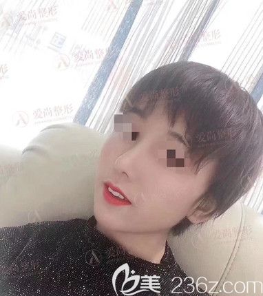 是時(shí)候公開(kāi)歪鼻梁的我在洛陽(yáng)愛(ài)尚做的鼻綜合整形手術(shù)全過(guò)程了