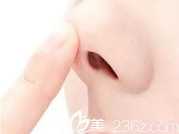 假體隆鼻后出現(xiàn)包膜攣縮怎么辦？