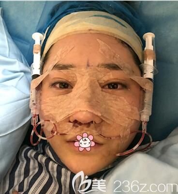 黨寧醫(yī)生給我做的手術(shù) 黨寧醫(yī)生給我做的手術(shù)