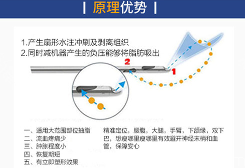 <!--<i data=20240709-sp></i>-->醫(yī)院吸脂優(yōu)勢