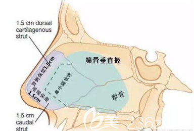 不取出全部的鼻中隔軟骨來做隆鼻手術(shù)是不會(huì)造成鼻部塌陷問題的