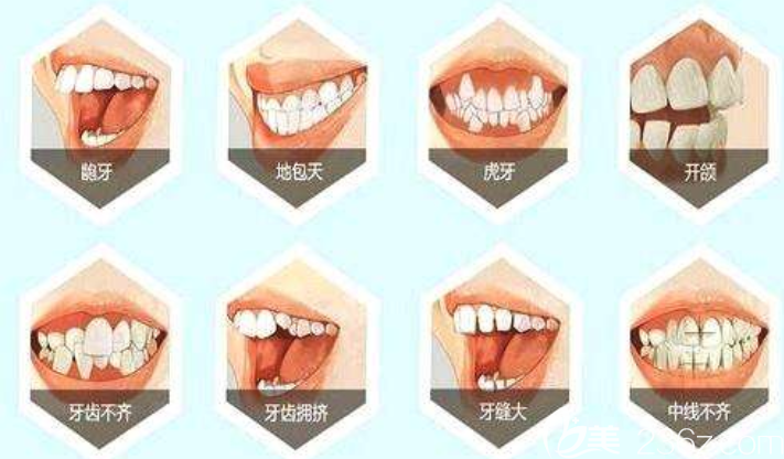 哪些人需要做牙齒矯正 哪些人需要做牙齒矯正