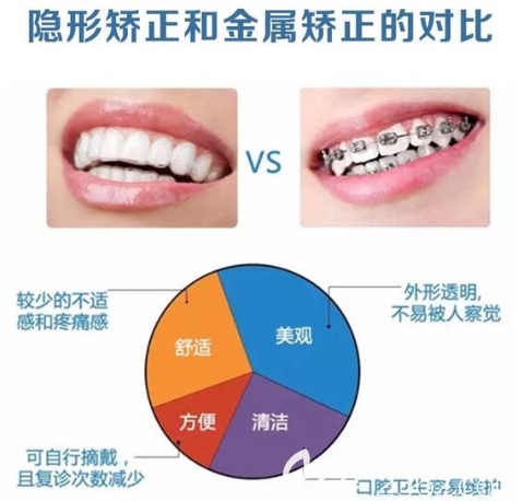 隱形矯正和金屬矯正對(duì)比圖告訴你哪種好 隱形矯正和金屬矯正對(duì)比圖告訴你哪種好