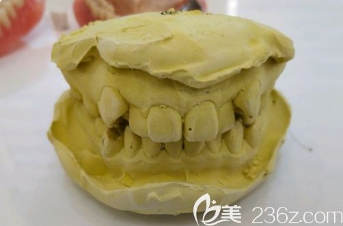 在長沙美奧口腔拍牙片 在長沙美奧口腔拍牙片