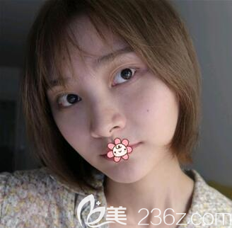 重慶時(shí)光整形做輪廓手術(shù)怎么樣