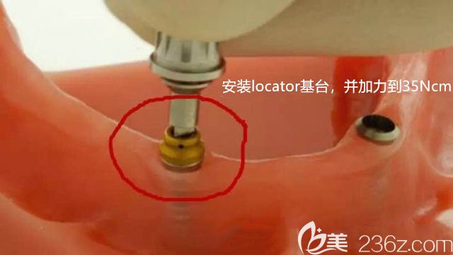 安裝上locator基臺(tái)后圖示 安裝上locator基臺(tái)后圖示