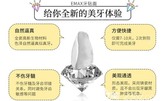 emax牙貼面給您全新的美牙體驗(yàn) emax牙貼面給您全新的美牙體驗(yàn)
