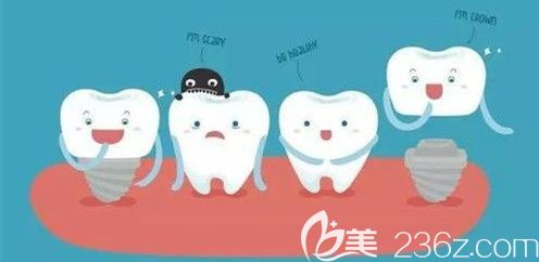 牙齒缺失做種植牙好還是烤瓷牙好