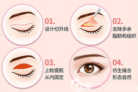 深圳yestar藝星整形謝文文雙眼皮手術(shù)過(guò)程圖 深圳yestar藝星整形謝文文雙眼皮手術(shù)過(guò)程圖