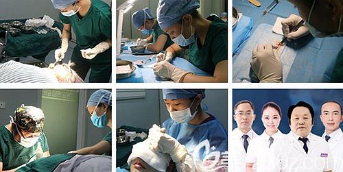 院內(nèi)擁有專業(yè)的植發(fā)醫(yī)師團(tuán)隊(duì)