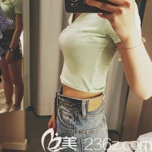 做吸脂瘦腰腹術(shù)后45天恢復(fù)效果 做吸脂瘦腰腹術(shù)后45天恢復(fù)效果