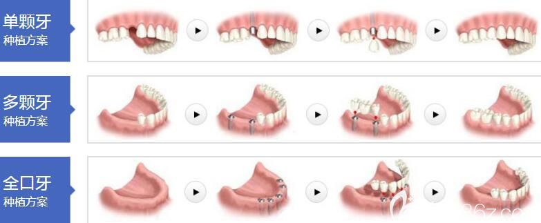 成都極光口腔林峰擅長項(xiàng)目 成都極光口腔林峰擅長項(xiàng)目