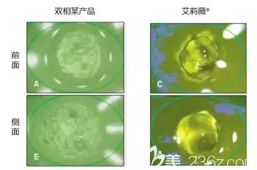 艾莉薇玻尿酸的優(yōu)勢