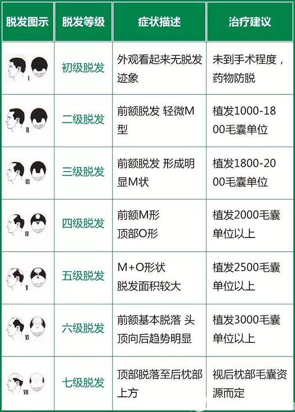 脫發(fā)等級(jí)示意圖(參考) 脫發(fā)等級(jí)示意圖(參考)