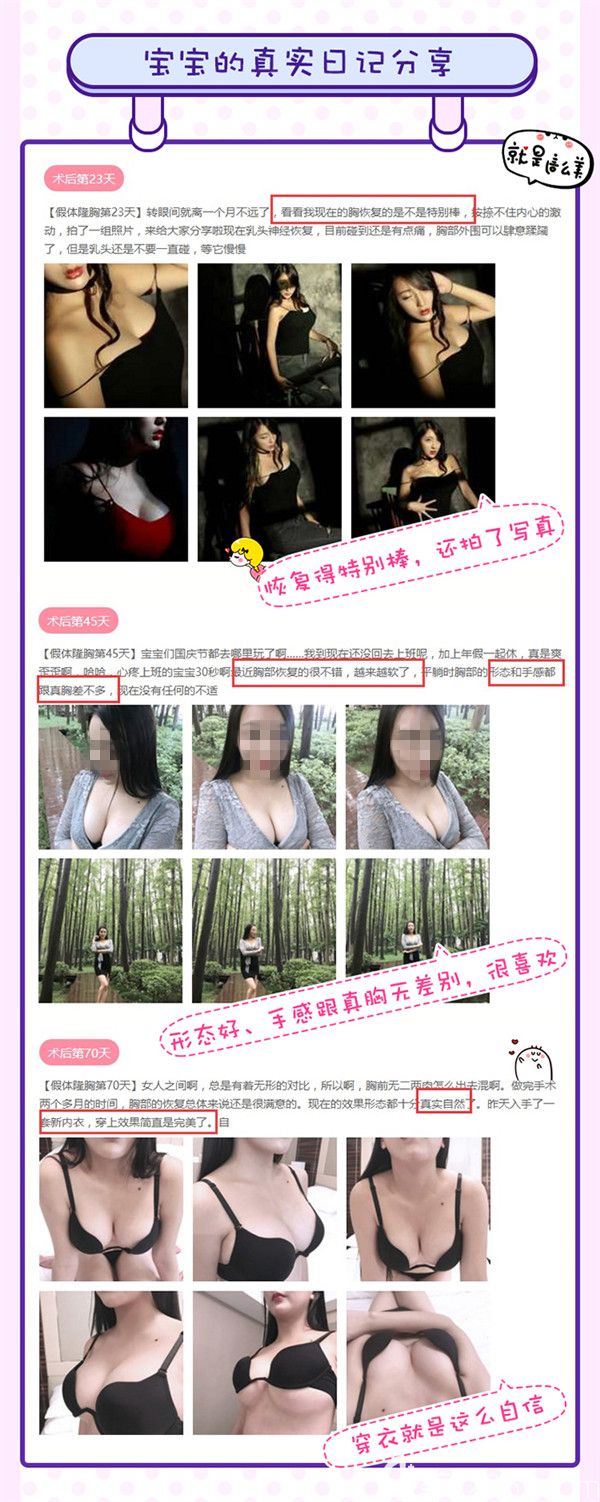 真實的寶寶隆胸術(shù)后日記分享反饋