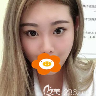 術(shù)后兩個(gè)月照片 術(shù)后兩個(gè)月照片