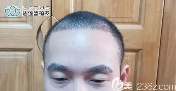 看到這些剛長出來的小毛茬，我就開心