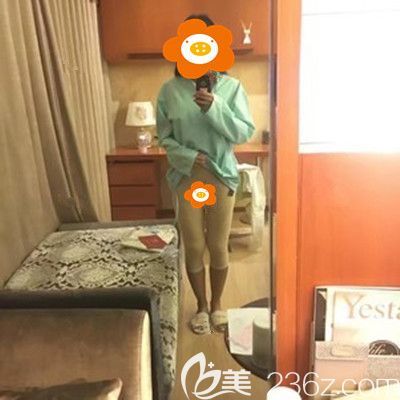 術(shù)后半個月穿塑身褲照片 術(shù)后半個月穿塑身褲照片
