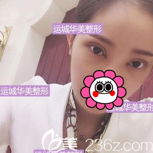 術(shù)后10天到院拆線眼睛輕微紅腫 術(shù)后10天到院拆線眼睛輕微紅腫