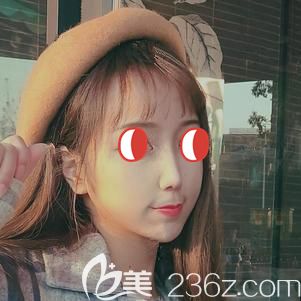 22歲出現(xiàn)皮膚下垂初老癥狀不要怕，埋線提升抗衰比較要有姓名