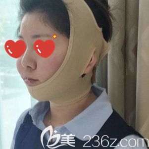 射頻溶脂瘦臉術(shù)后即刻