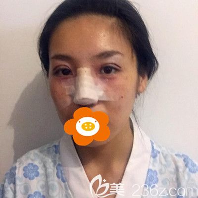 剛做完手術(shù)拍的照片 剛做完手術(shù)拍的照片