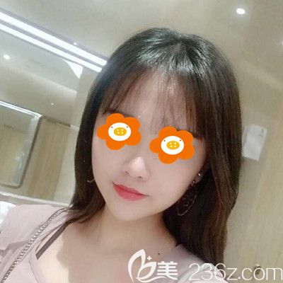 聽說面部埋線提升手術維持時間不長，但看我恢復3個月效果也算是吃了一顆定心丸