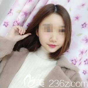 鼻綜合術后1個月鼻子完全消腫