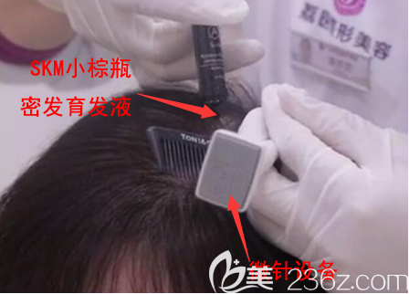 這是我使用密發(fā)小棕瓶的照片